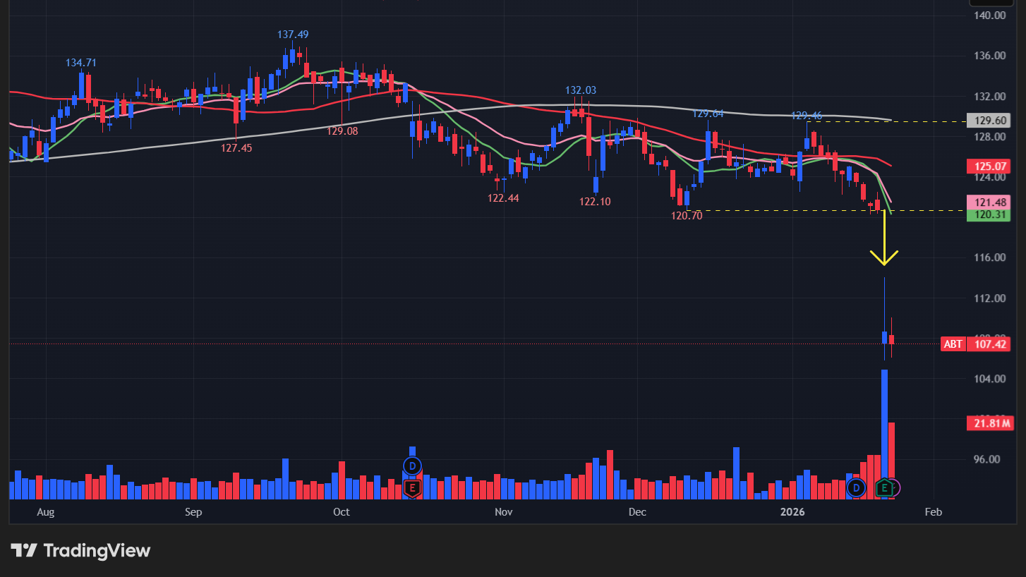 アボットラボラトリーズ(ABT)