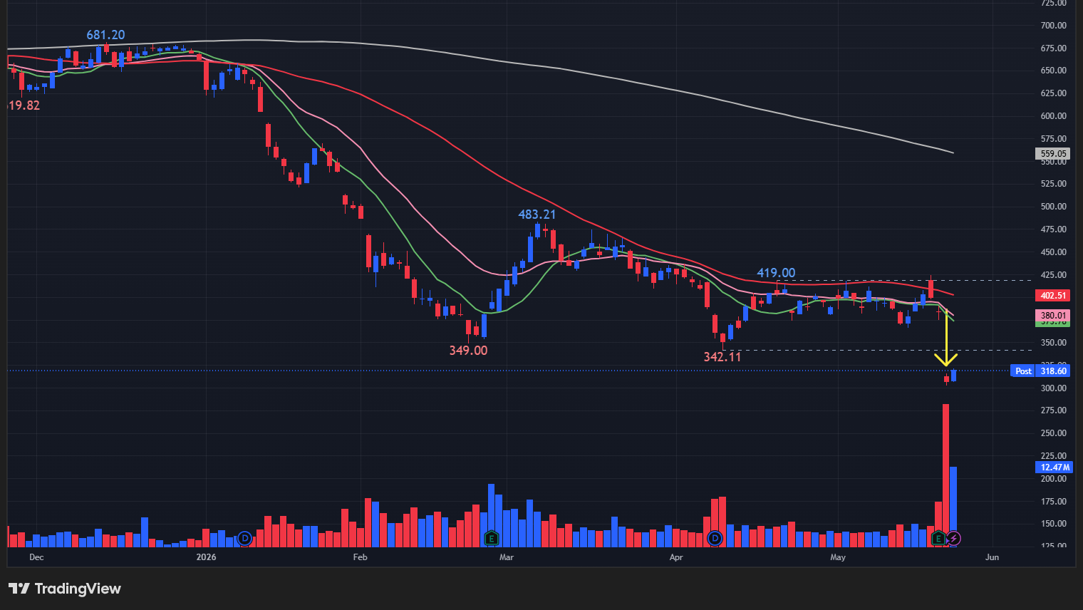【INTUの日足チャート】　※TradingView提供