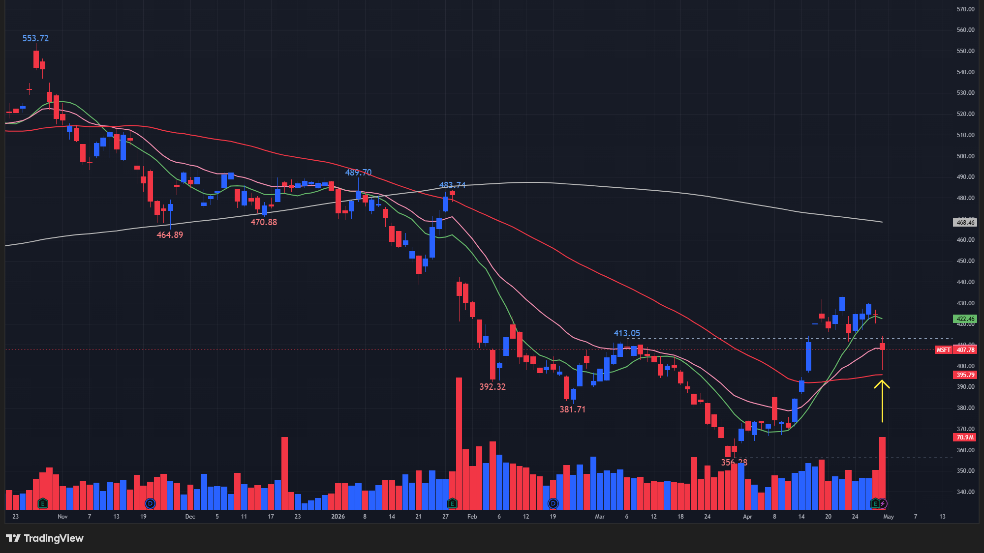 【MSFTの日足チャート】　※TradingView提供
