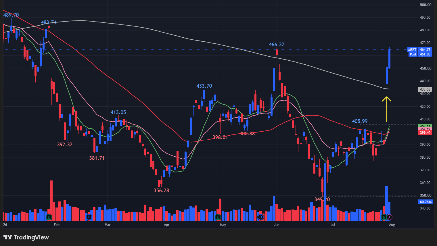 【MSFTの日足チャート】　※TradingView提供